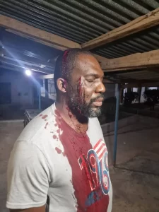 Soldiers Beat Up Rep In Benue